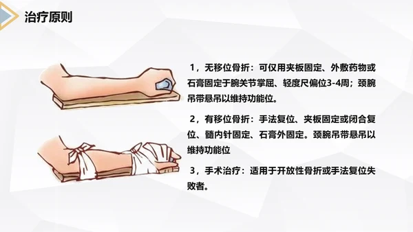 左桡尺骨双骨折护理查房通用PPT模板