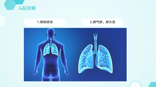 蓝色六边形简约商务肺部感染护理查房PPT医学PPT模板