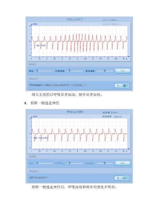 家兔呼吸运动的调节实验报告