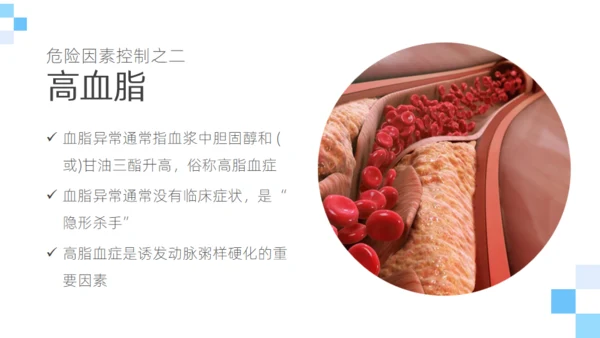 脑卒中健康科普通用PPT模板