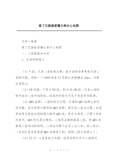 看了它就能看懂大部分心电图.docx