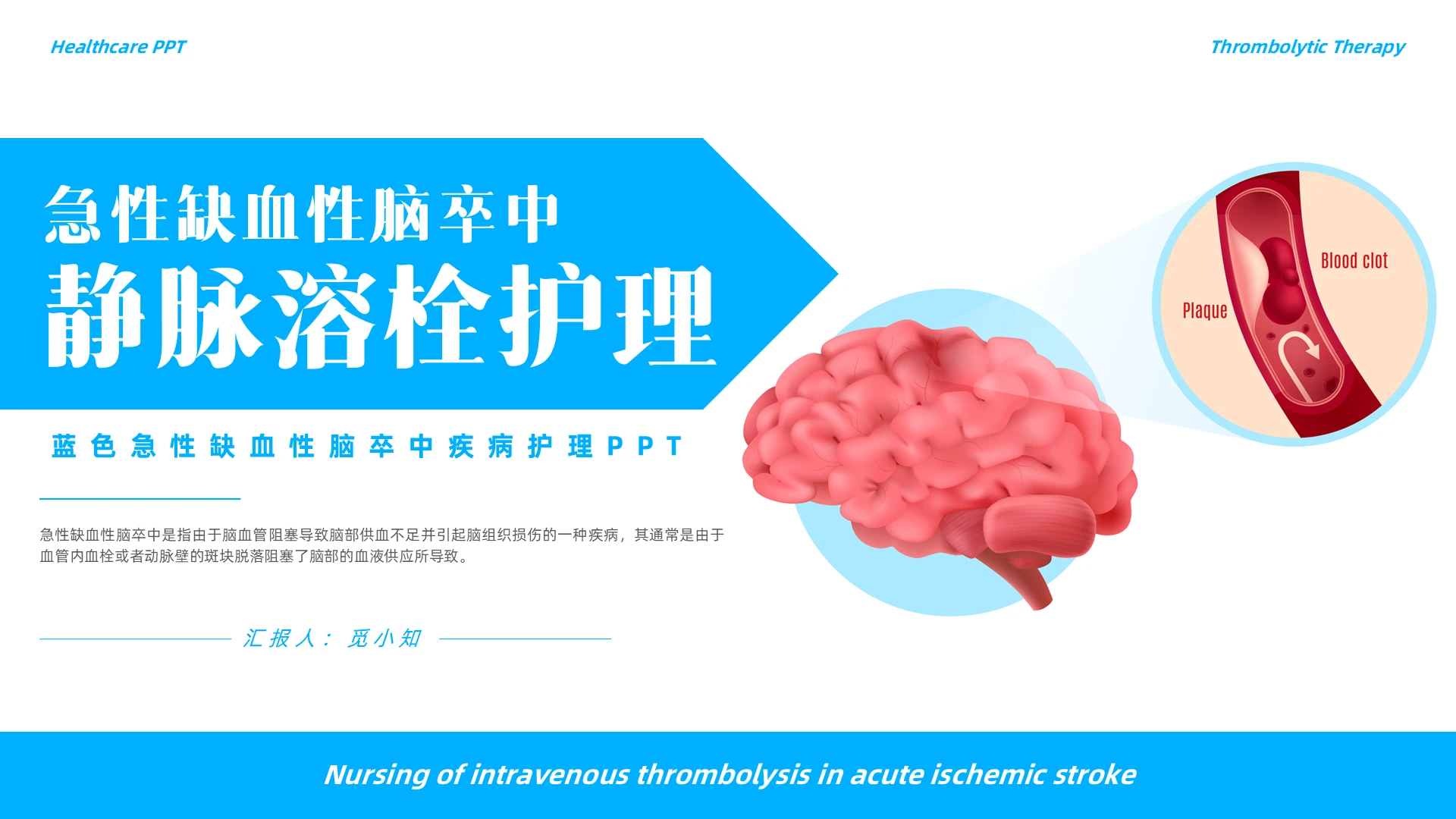 简约插画急性缺血性脑卒中静脉溶栓护理疾病护理护理查房个案护理
