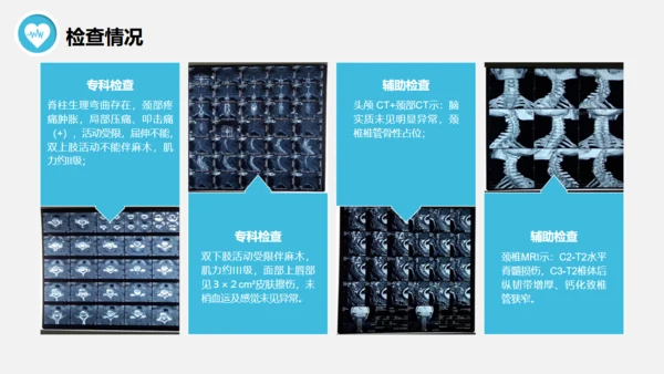 脊髓损伤术后护理查房通用PPT模板