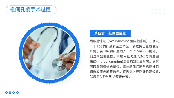 蓝色简约椎间孔镜术后护理PPT模板宣传PPT动态PPT