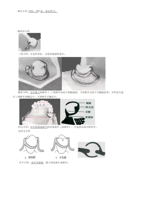 口腔主治医师考试专业实践能力口腔修复学牙列缺损修复