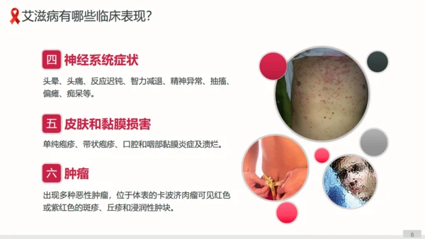 预防艾滋病科普宣讲通用PPT课件